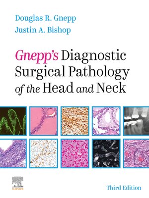 cover image of Gnepp's Diagnostic Surgical Pathology of the Head and Neck E-Book